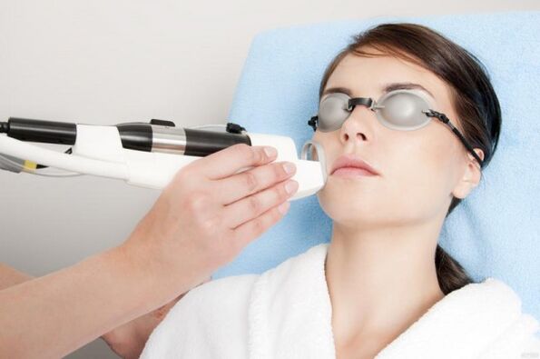 performing a procedure for laser skin rejuvenation