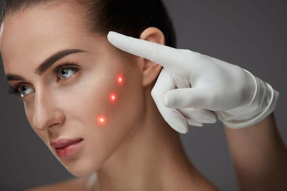 Laser facial rejuvenation