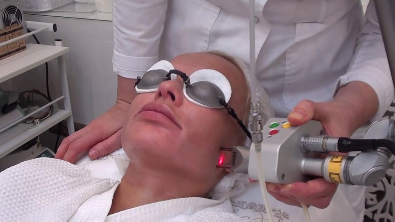 Treatment with laser beams of problem areas of the facial skin